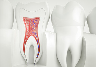 Endodontie | Wurzelkanalbehandlung